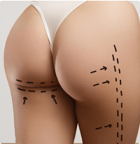 procedure