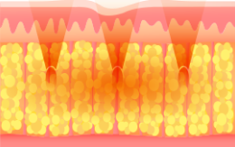 procedure