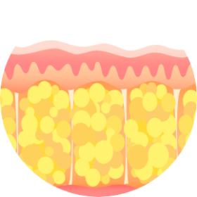 procedure