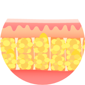 procedure
