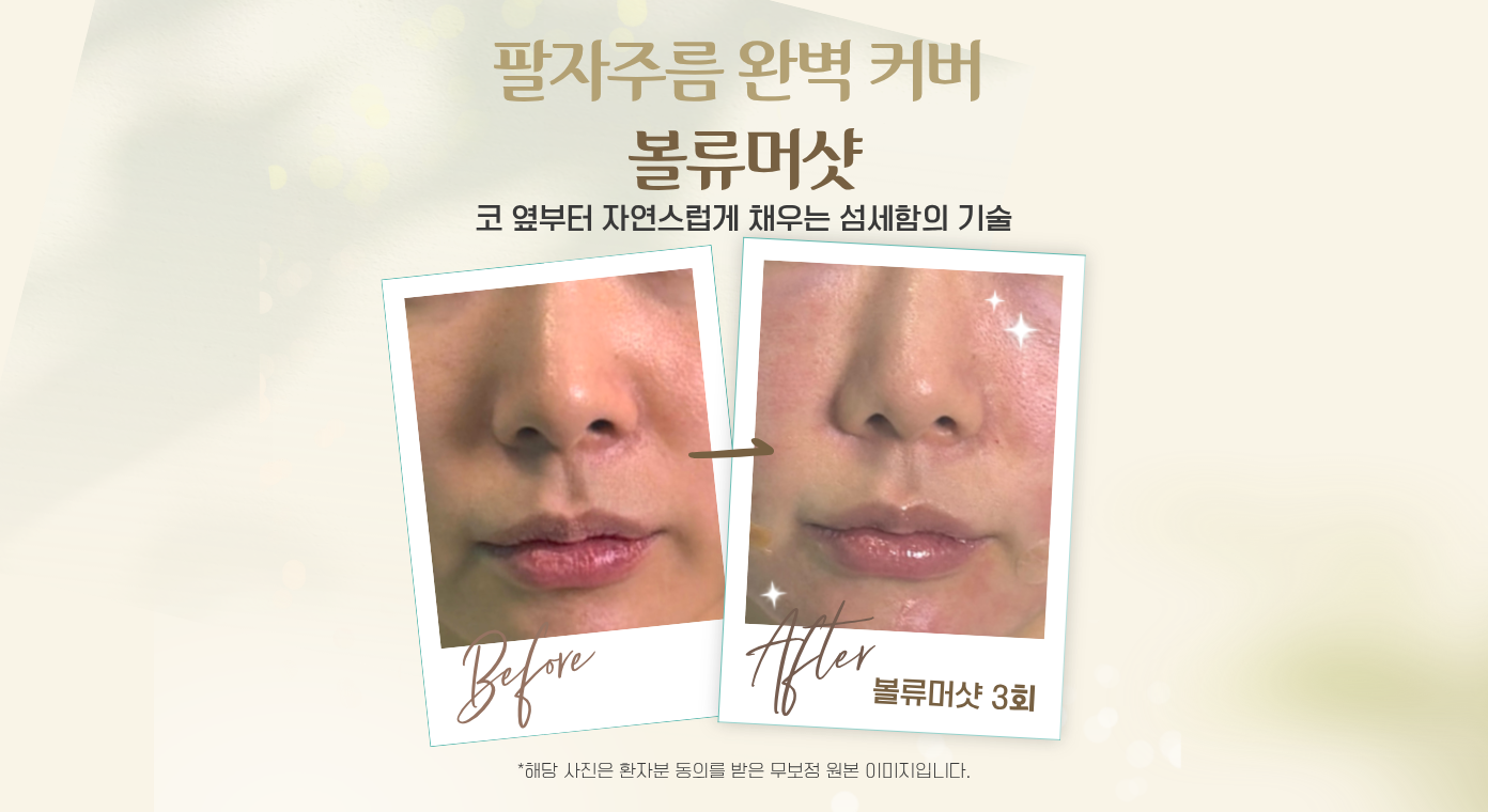 볼류머샷 이벤트